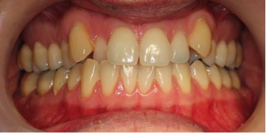 L’orthodontie